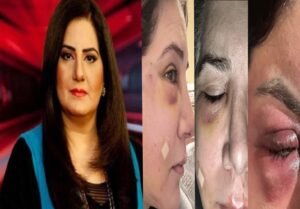 جیسمین منظور کی شیئر کردہ تصویر، آنکھ پر سوجن کے ساتھ