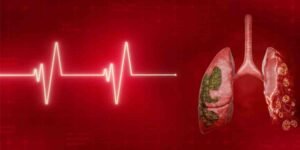 الٹرا پروسیسڈ خوراک اور پھیپھڑوں کے کینسر کے بڑھتے خطرے پر تحقیق اورپھیپھڑوں کے کینسر کا خطرہ