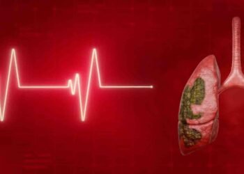 الٹرا پروسیسڈ خوراک اور پھیپھڑوں کے کینسر کے بڑھتے خطرے پر تحقیق اورپھیپھڑوں کے کینسر کا خطرہ