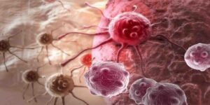 کینسر سے بچاؤ کے لیے تیز چہل قدمی کی عادت