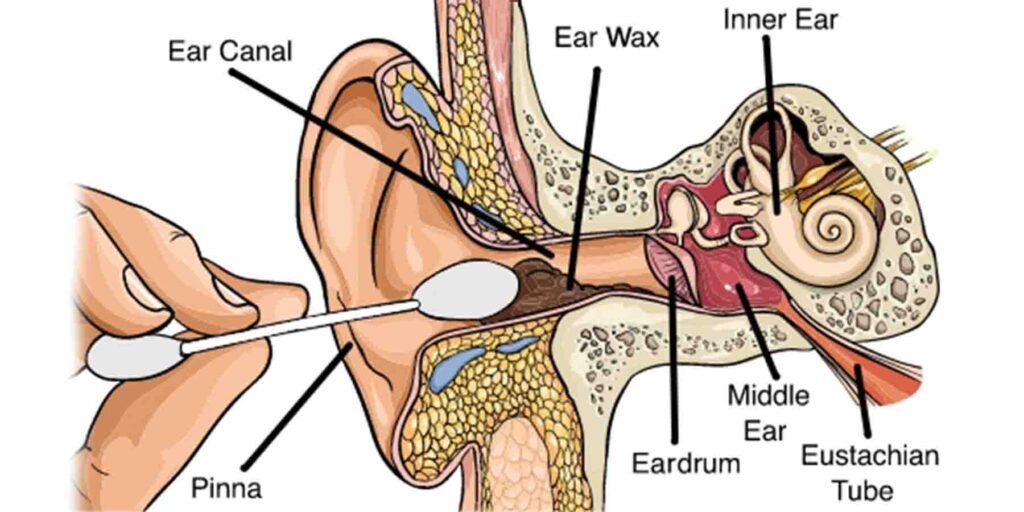 کاٹن بڈز کا نقصان