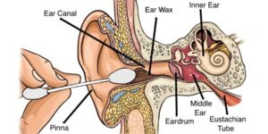 کاٹن بڈز کا نقصان