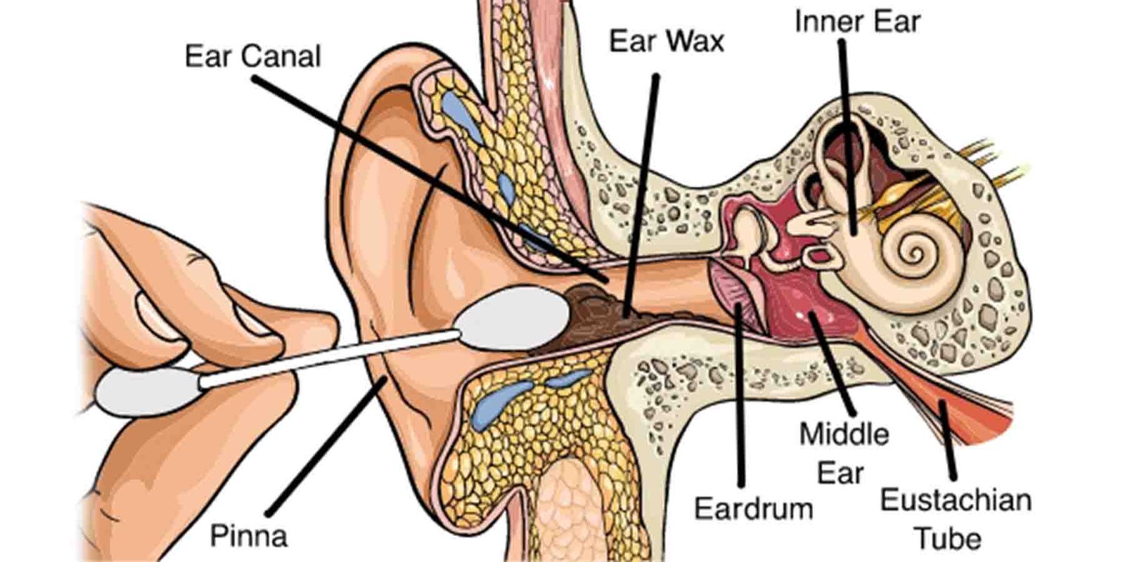 کاٹن بڈز کا نقصان