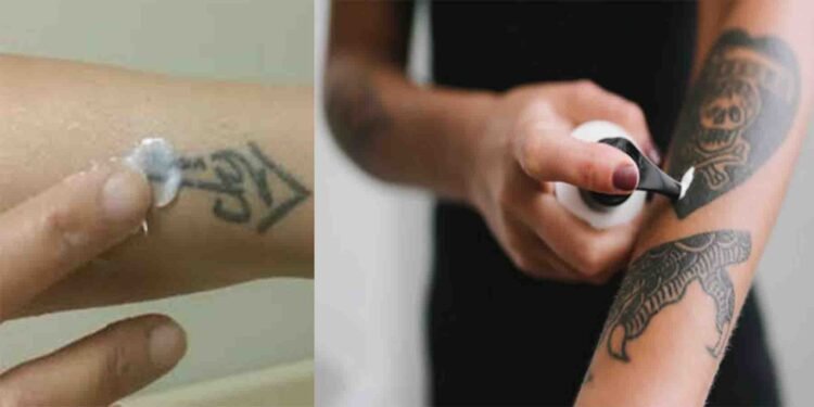 جلد سے ٹیٹو مٹانے والی کریم ایک محفوظ اور مؤثر ایجاد