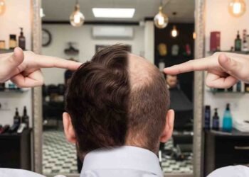 گنج پن کا علاج — سٹیوسائیڈ سے قدرتی بال اُگانے کی نئی امید