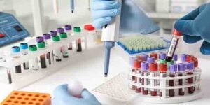 سندھ ہیلتھ کیئر کمیشن نے ڈینگی، ملیریا اور سی بی سی ٹیسٹوں کی قیمتوں میں کمی کی