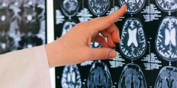 لیڈی ریڈنگ ہسپتال دماغ آپریشن – ڈاکٹر عقیل پاپانی اور ایل آر ایچ ٹیم کے ساتھ