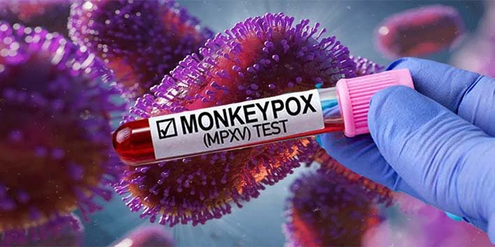 لاہور میں منکی پاکس وائرس کے مریض اور وائرس کی تشویشناک تصویر