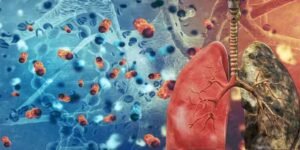 پھیپھڑوں کے کینسر کی وجہ بتانے والی نئی طبی تحقیق