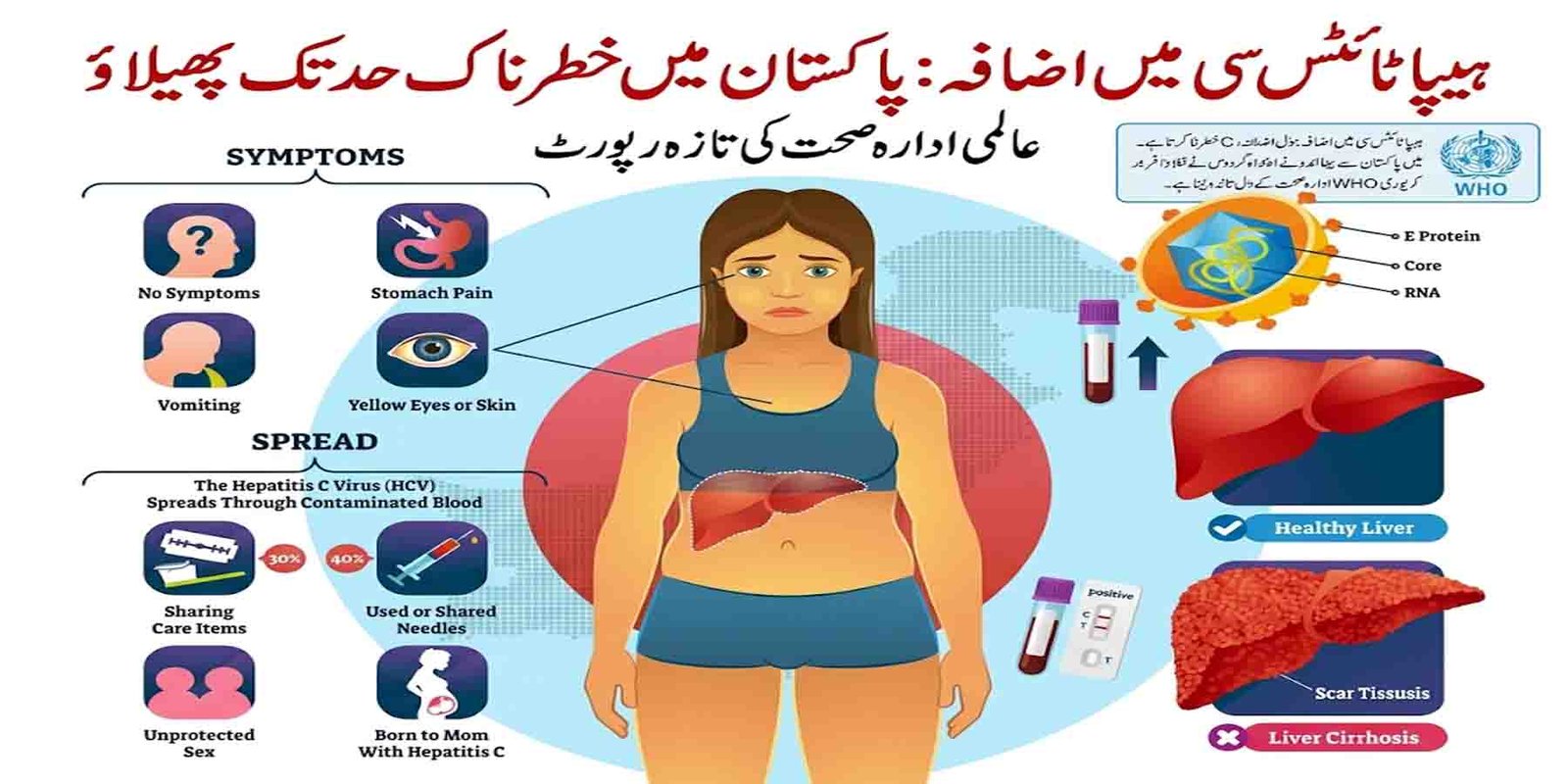 ہیپاٹائٹس سی میں اضافہ: پاکستان میں خطرناک حد تک پھیلاؤ، عالمی ادارہ صحت کی رپورٹ