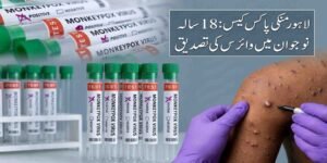 لاہور منکی پاکس کیس: 18 سالہ نوجوان میں وائرس کی تصدیق