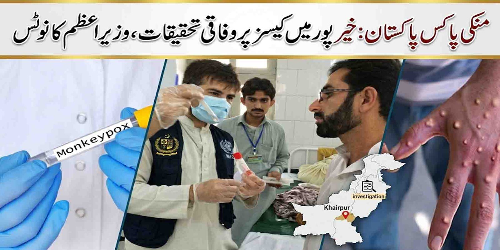 منکی پاکس پاکستان خیرپور کیسز تحقیقات صحت ٹیم