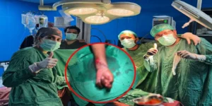 ہولی فیملی ہسپتال میں 5 سالہ بچے کے کٹے ہاتھ کی کامیاب ری پلانٹیشن